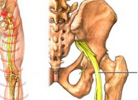 sciatic